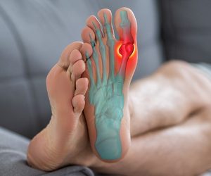 Joint diseases, hallux valgus, plantar fasciitis, man's leg hurts, pain in the foot, health problems concept