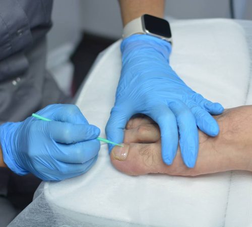 Индивидуальные занятия с подологом, сертикат международного образца, отработка на моделях